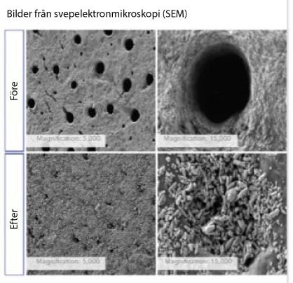 Bilder från svepelektronmikroskopi (SEM)